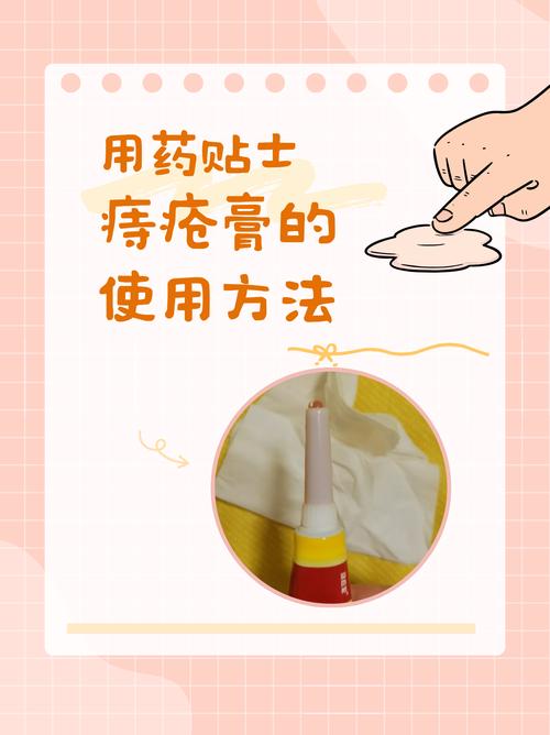 痔疮膏的正确使用方法-第6张图片 痔疮膏的正确使用方法-第6张图片