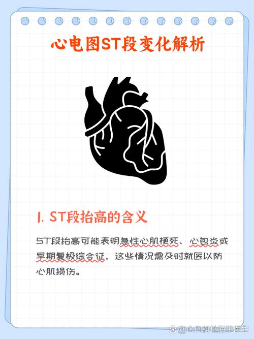 苏宁股票停盘st又是什么