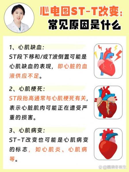 苏宁股票停盘st又是什么-第7张图片 苏宁股票停盘st又是什么-第7张图片