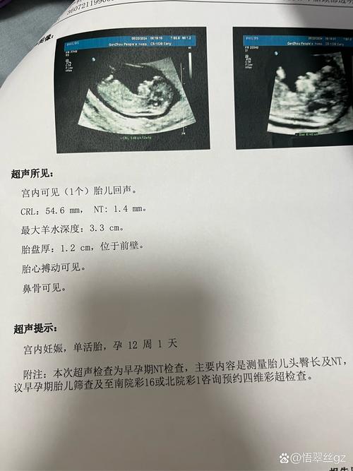 美元兑台币汇率查询，美元兑新台币实时汇率查询-第6张图片